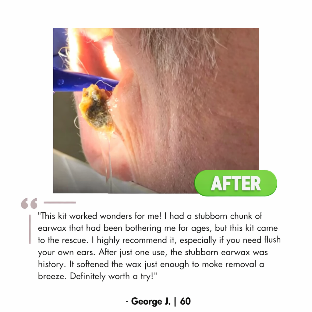 Zeyora Electric Ear Wax Removal Kit