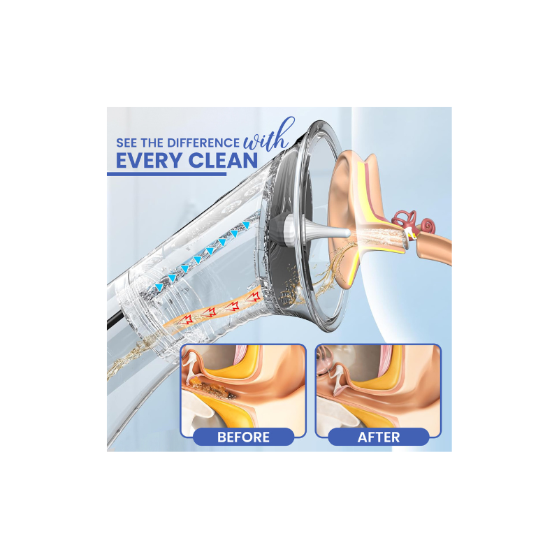 Electric Ear Wax Removal Irrigation Device